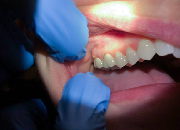 Best Urgent Care for Lost Fillings or Crowns in Gruetli Laager, TN